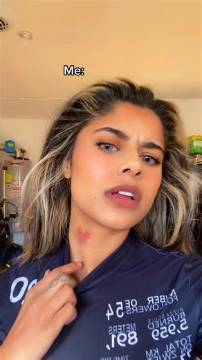 Understanding Love Bites: How to Give, Cure, and Recognize Love Bites