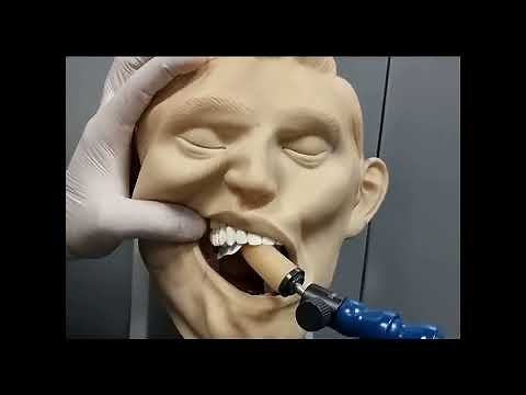 Intra Oral Radiography. Bisecting Angle Technique Demo. Vertical, Horizontal angles, Point of Entry