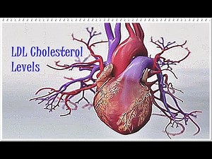 LDL Cholesterol High? Tips to Lower the Levels