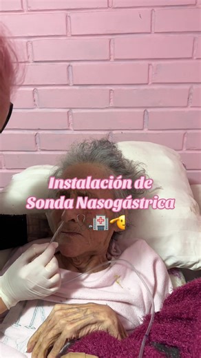 Instalación de Sonda Nasogástrica: Guía Práctica