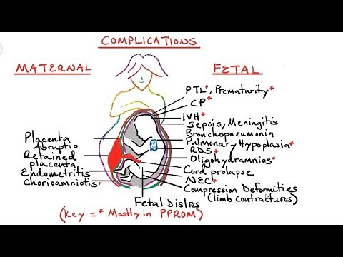 Preterm Premature Rupture of Membranes (pprom) and Chorioamniotis