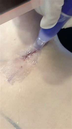 How To Apply Sterile Wound Glue #goodtoknow #vet #medicine #educational #funfacts #lifehacks #learn
