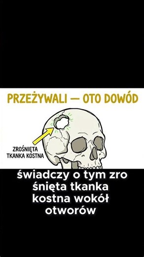 Operacja mózgu 8000 lat temu?! 🤯