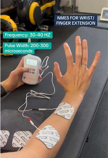 NMES Techniques for Wrist and Finger Extension