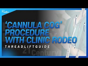 Thread Face Lift Guide | Cannula Cog Procedure with Clinic Rodeo | 21 Century Medical