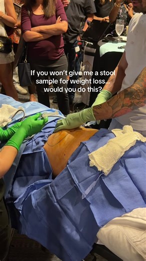 this helps your body burn fat without major surgery… Yesterday I went to the InMode convention at the Fairmont Princess in Scottsdale, and saw a machine that can remove fat at the subcutaneous level without liposuction. 🤯 What’s wild about it: • No major surgery • No downtime • The fat reduction happens gradually over time • The biggest results show around 9 months Your body slowly processes and eliminates the fat cells after treatment. 🔥 Not going to lie… everyone standing around watching the