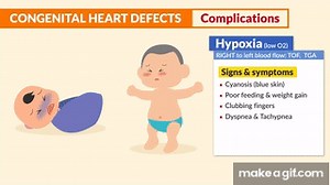 Congenital Heart Defects Nursing | Learn Pediatric Cardiac Defects on Make a GIF