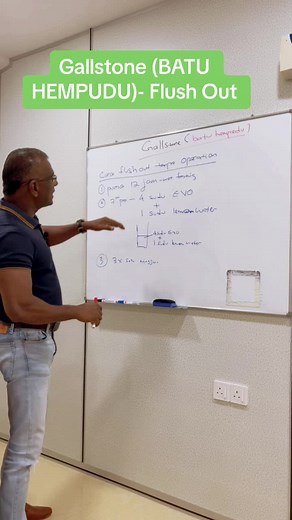 Flush Out Gallstone Naturally with Liver Flush Method