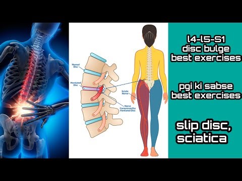 exercise for L4-L5-S1 disc bulge, herniated disc, slip disc exercise, sciatica, pgi best exercises