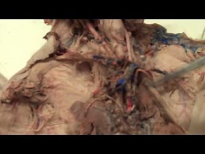 Fetal Pig Dissection: 4.4 Arteries Cranial to the Heart