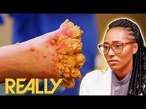 Doctor Diagnoses A Patient With Mysterious Wart-Like Growths | My Feet Are Killing Me