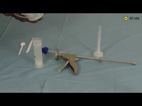 Advantage Bone Cement Gun, bone cement syringe kit (dispenser) and femoral pressurizer