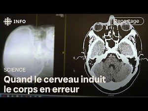 Functional Neurological Disorder: When the Brain Goes Off the Rails | Discovery