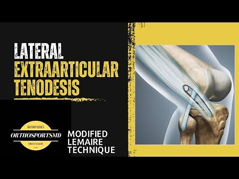 Lateral Extraarticular Tenodesis - Not your ordinary ACL reconstruction
