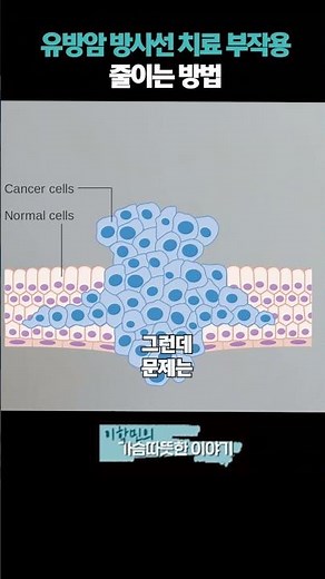 유방암 방사선 치료 부작용 줄이는 방법!? #방사선치료 #방사선폐렴 #방사선치료부작용