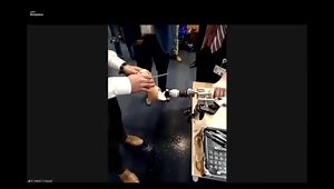 Lab 3B: Connecting the Prosthetic to the Tibia OI (ALM Ortho Lab)