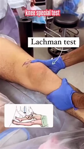 DR.VIKAS PANDEY (PT) on Instagram: "Special Tests for Knee Joint 1. Meniscal Tests McMurray Test – Meniscal tear Apley’s Compression Test – Meniscus vs ligament injury Thessaly Test – Meniscal pathology Joint Line Tenderness – Meniscus injury 2. Ligament Tests ACL (Anterior Cruciate Ligament) Lachman Test (most sensitive) Anterior Drawer Test Pivot Shift Test PCL (Posterior Cruciate Ligament) Posterior Drawer Test Posterior Sag Sign (Godfrey’s Test) MCL (Medial Collateral Ligament) Valgus Stress