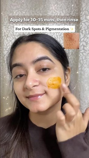 Fix your skin problems under 10rs💫 #vaselineuses #skincare #shorts #ytshorts