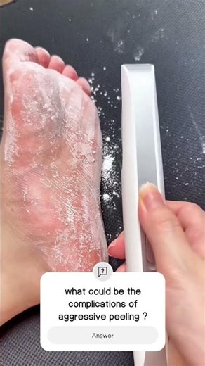 skin peeling #satisfying #cosmeticdermatology