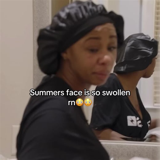 Summers face is so swollen rn omg #baddiesusa #zeusnetwork #summerbaddies