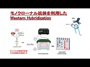 モノクローナル抗体とWestern Hybridization