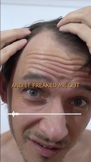 Kevin's Hair Loss Story | HairPod Shorts