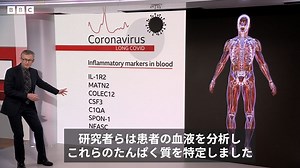 コロナ後遺症、血液中の特定のたんぱく質が原因か　将来の治療に期待＝英研究 - BBCニュース
