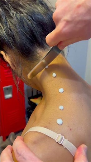 Instrument Assisted Soft Tissue Mobilization (IASTM)