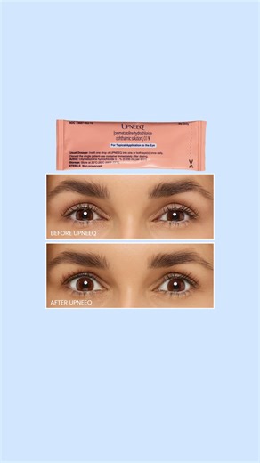 $20 off the only FDA-approved drop for non-surgical eyelid lift, for adults with low-lying eyelids. Get the eye drop that lifts at upneeq.com. *Prescription and telehealth visit required; an additional fee applies for telehealth visit. $20 off valid for new customers on orders of $50 or more with email signup. Visit Upneeq.com or talk to your doctor to learn more. UPNEEQ® (oxymetazoline hydrochloride ophthalmic solution), 0.1% is a prescription eyedrop used to treat acquired blepharoptosis (low-