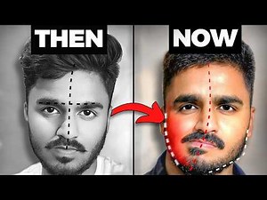 STOP Doing These 5 Things (Creating Facial Asymmetry)