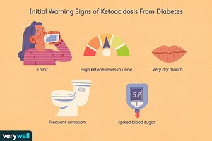 Diabetic Ketoacidosis (DKA) As the name implies, diabetic...