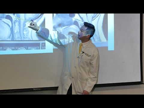 "Surgical Treatment of Chiari Malformation" - Michael Chan, MD