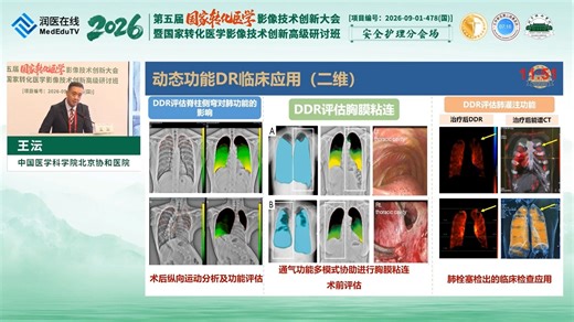 动态功能DR检查技术及临床应用-王沄