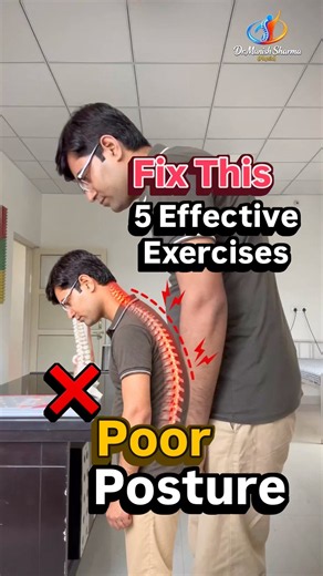How to fix poor posture? Try these five exercises!