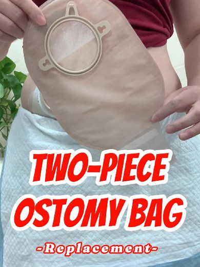 How to Change a Two-Piece Ostomy Bag Efficiently