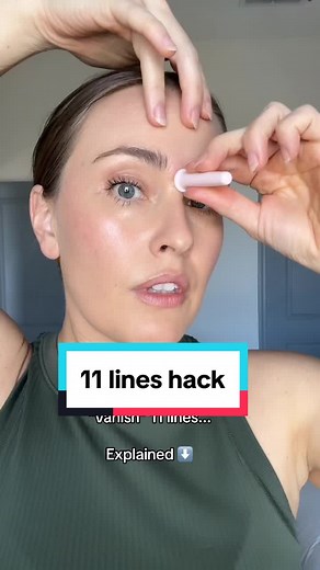 Dr. Lindsey (@drlindseyschmidt) - Effective Facial Cupping Technique for Softening 11 Lines