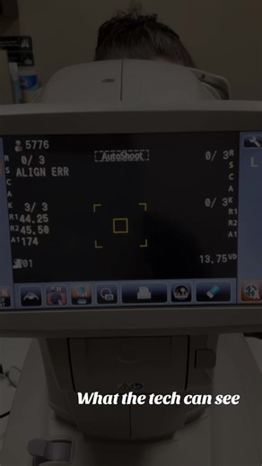 Understanding Auto Refractors in Eye Exams