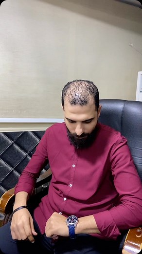 • 𝐌𝐄𝐍𝐍𝐀 • on Instagram