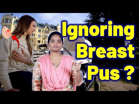 What Happens If You Neglect Breast Pus, Mastitis With Abscess, Infected Breast Lump | Gynaecology