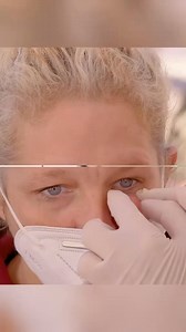 This was HUGE 🤯😱 #pimplepopper #drpimplepoppers #cyst #cystremoval #doctor #surgery #disease #plastic #hospital #pimplepopping #cyst #cystremoval #pimplepopping #skincareroutine #blackheadremoval #satisfyingvideos | Fail Army