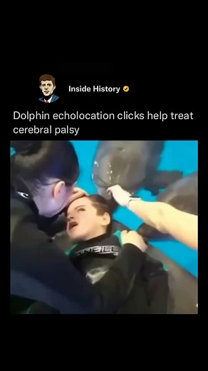 Inside History on Instagram: "Follow (us) @InsideHistory to learn something NEW everyday 🧠💫 Dolphin sound frequencies, particularly their ultrasonic echolocation clicks ranging from about 2,000 Hz up to 100,000 Hz, are believed to have potential therapeutic effects for children with cerebral palsy! These high-frequency sounds can create gentle vibrations that may influence brain activity by promoting relaxation and improving neural synchronization between brain hemispheres. This 