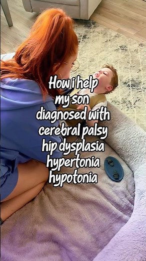 Cerebral palsy, hip dysplasia, hypertonia #cerebralpalsy #hypertonia #specialneeds