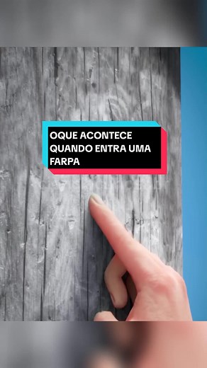 O que acontece quando entra uma farpa na pele?
