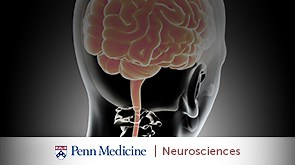 4 Latest Advances in Epilepsy Treatment at Penn