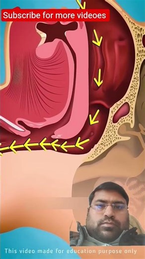 #snoringproblems#health#facts#animation#science#snoringsleepingsoundeffect#medicaleducation#trending
