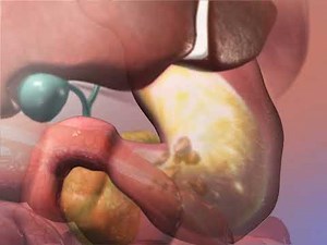 Absorption - Animation