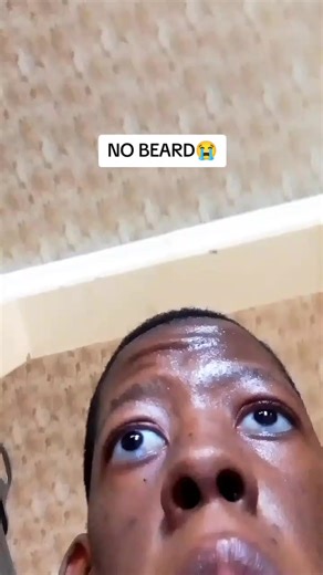 Where's my beard?😭 #fyp #beard #21 #credotheekid