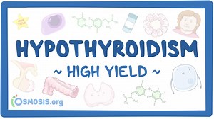 Hypothyroidism: Pathology review: Video, Causes, & Meaning | Osmosis