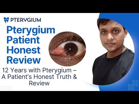 Pterygium Patient Honest Review: My 12-Year Experience ! Pterygium Surgery? Treatment?