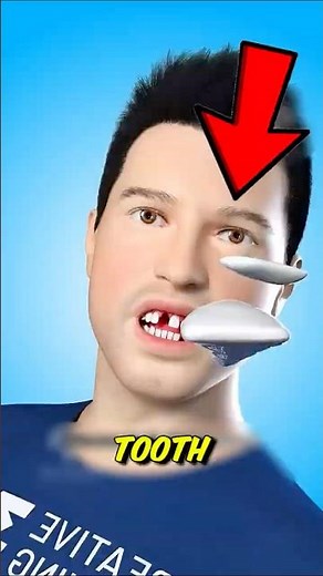 A Knocked Out Tooth Can Be Saved 😱🦷